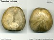 Toxaster_retusus